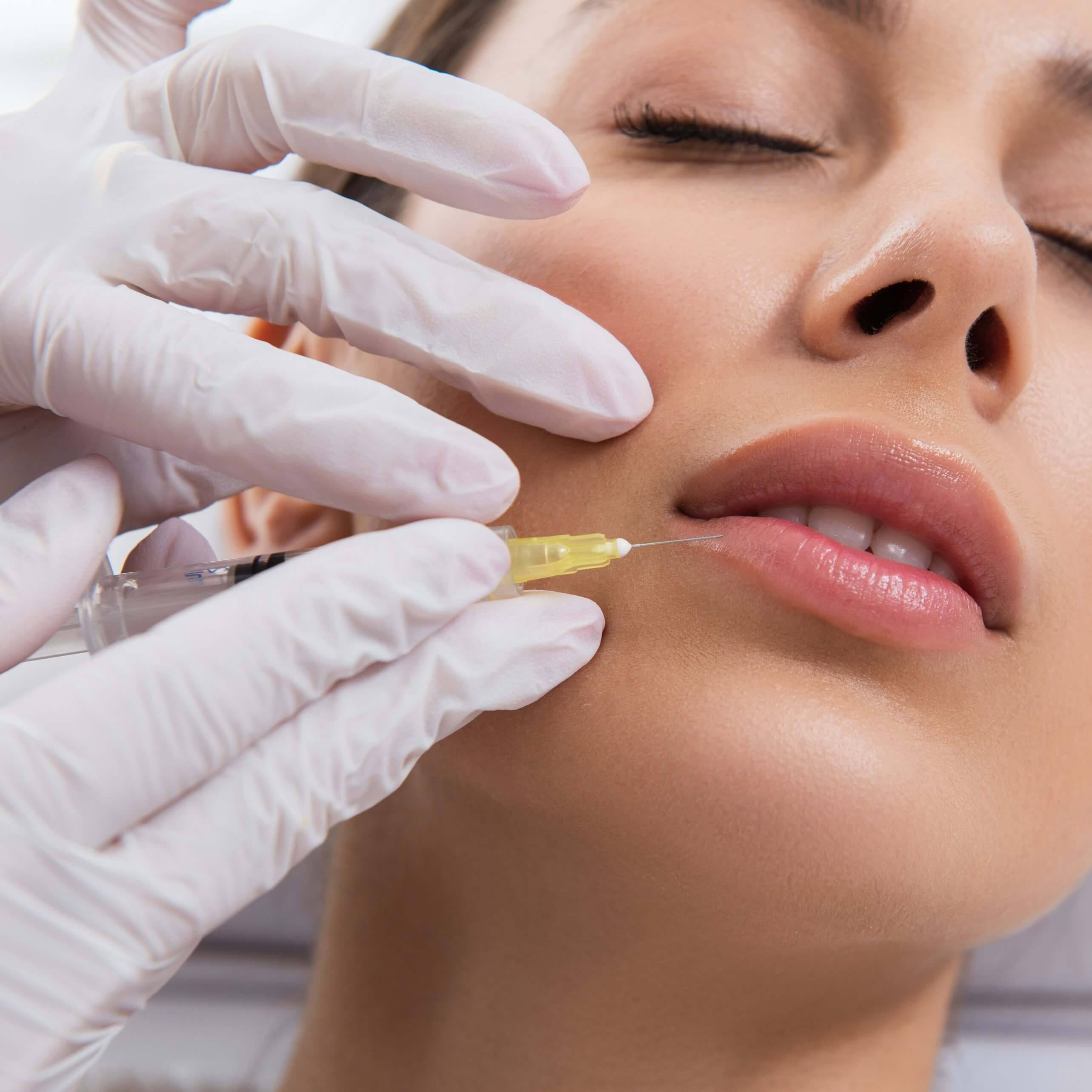 woman having lip filler treatment