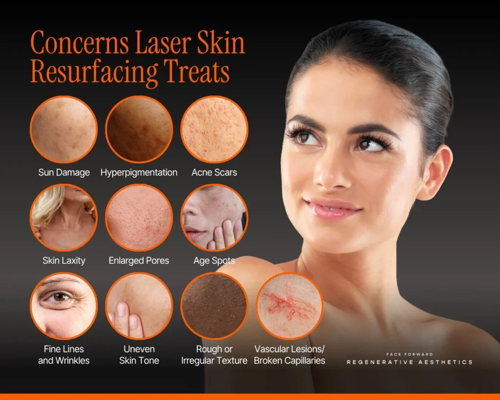 Graphic listing concerns that laser skin resurfacing treats