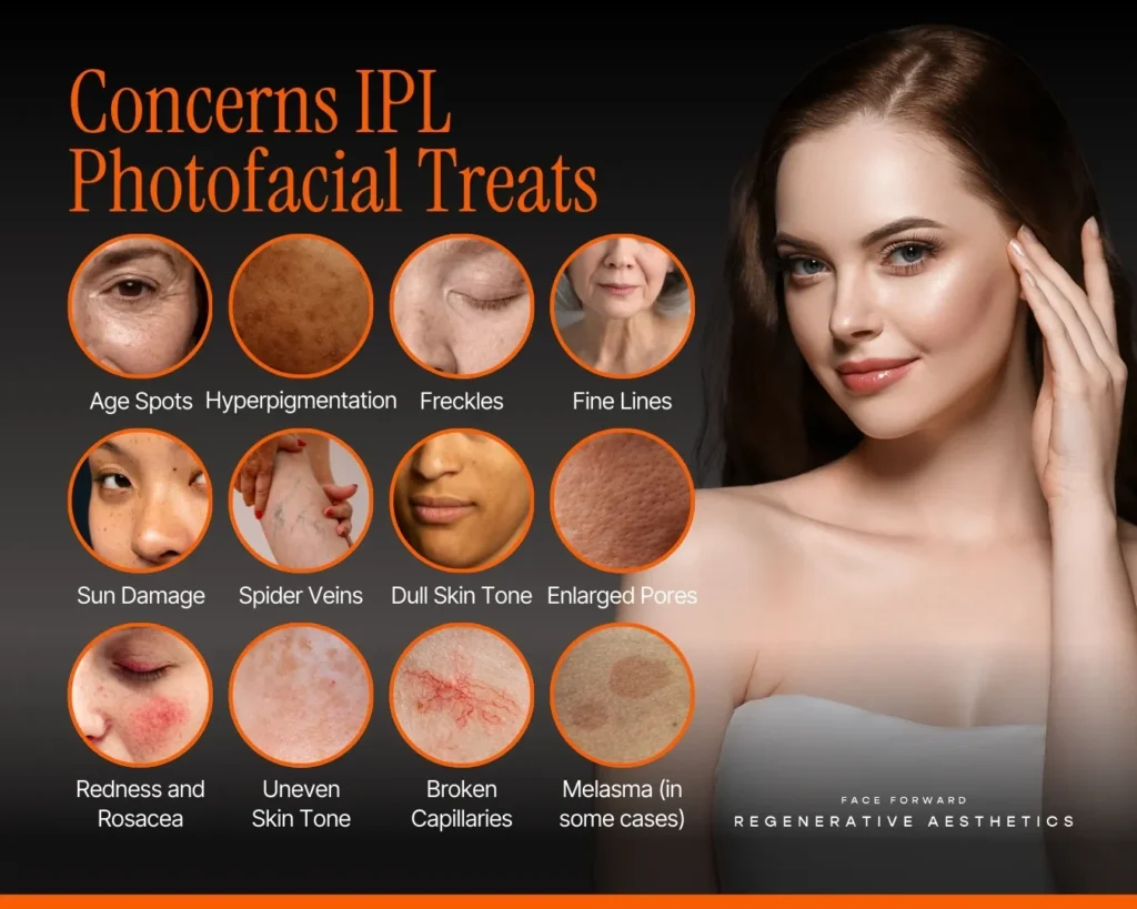 Concerns IPL treats