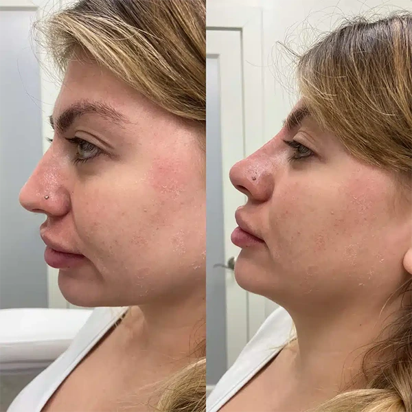 face-forward-aesthetic-clinic-st-louis-missouri-1