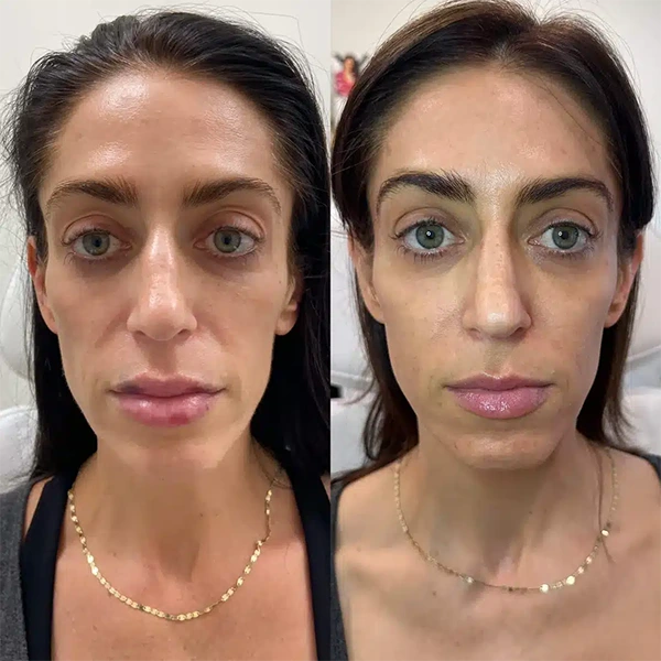 face-forward-aesthetic-clinic-st-louis-missouri-2